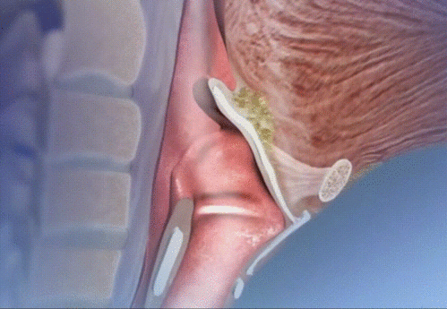 男生喉结图片,喉结图片解析